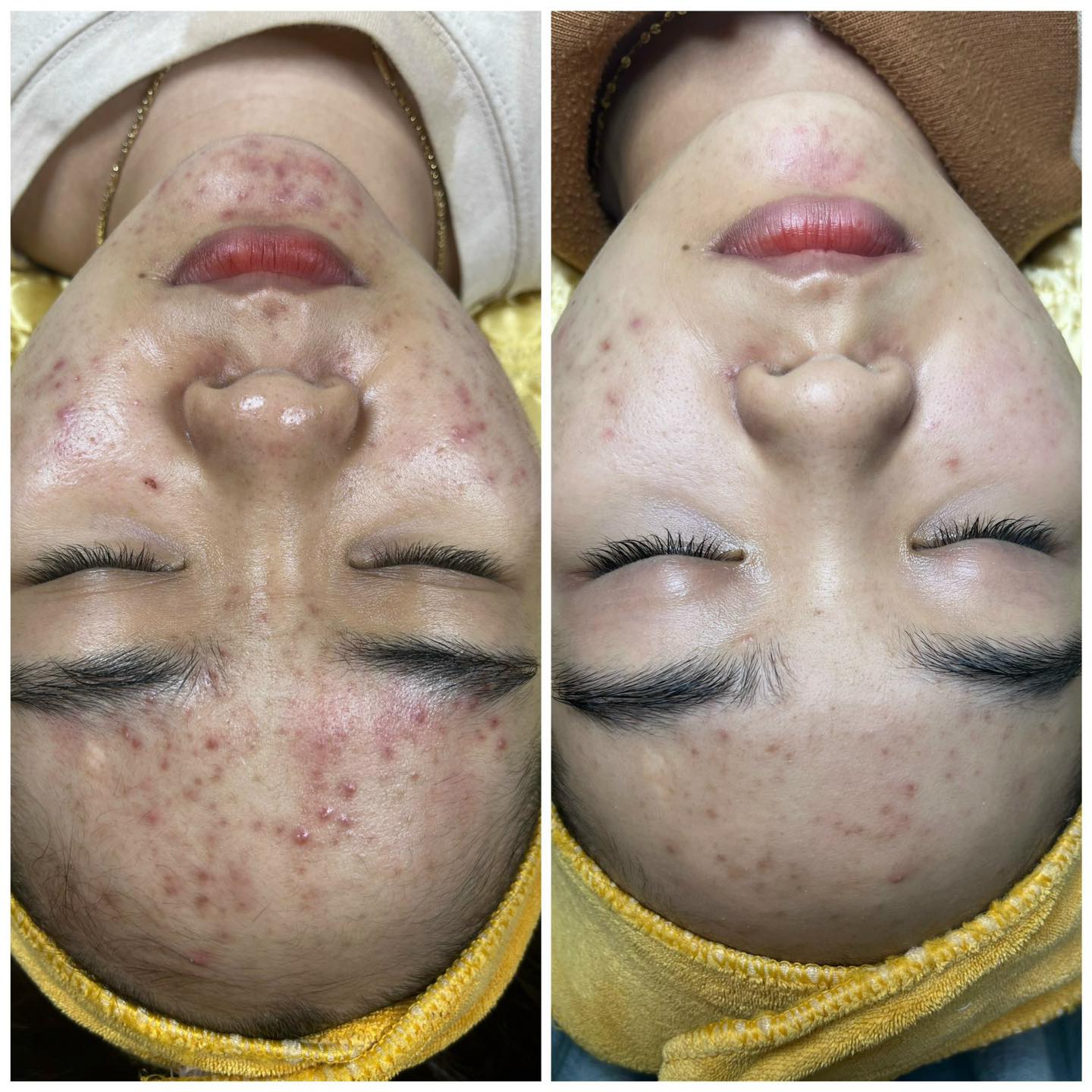 Naina Spa ảnh 1