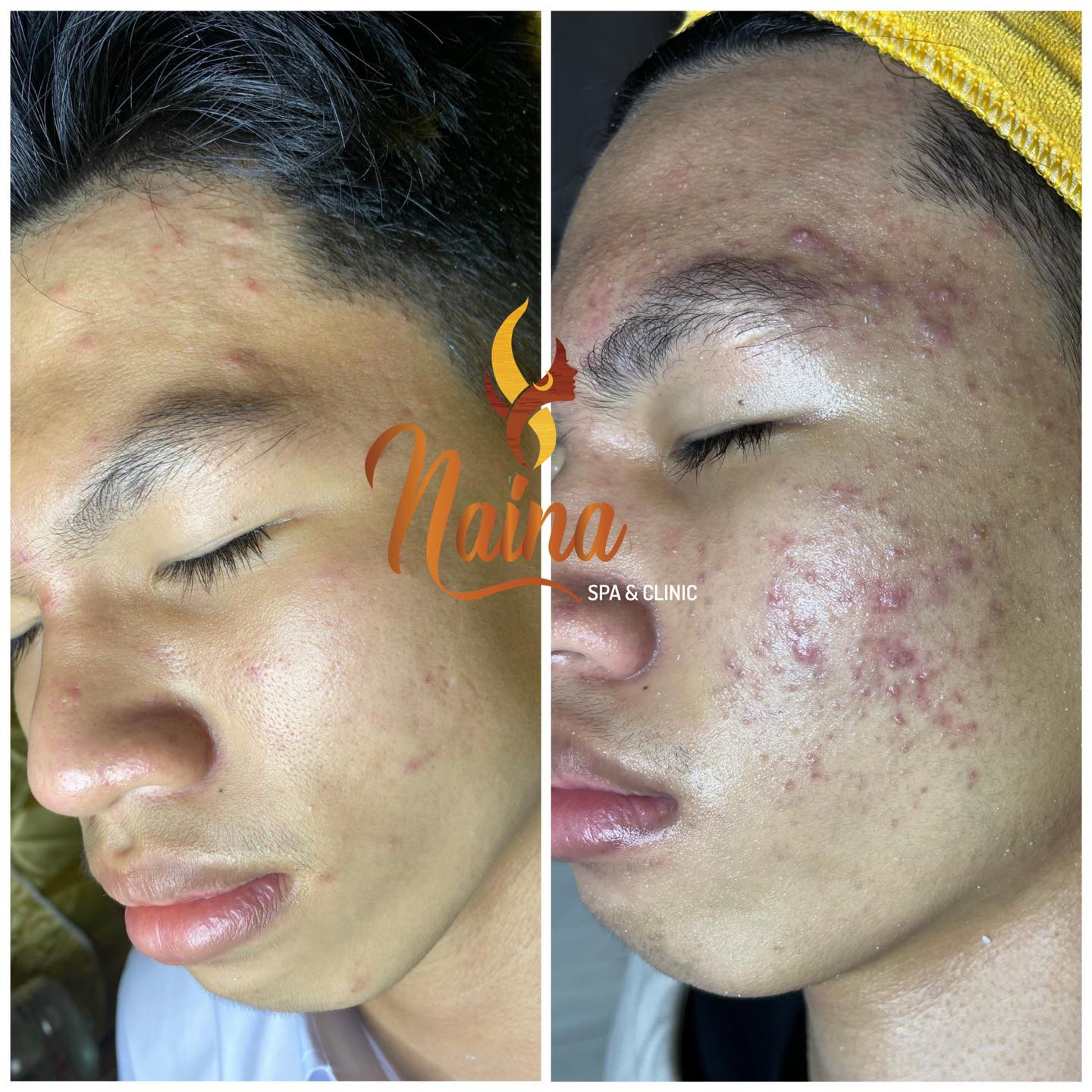 Naina Spa ảnh 2