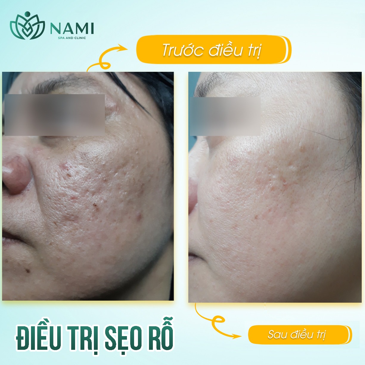 Nami Spa Beauty & Clinic ảnh 2