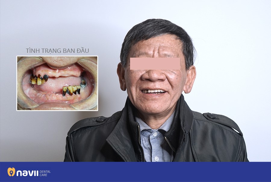 Navii Dental Care ảnh 2