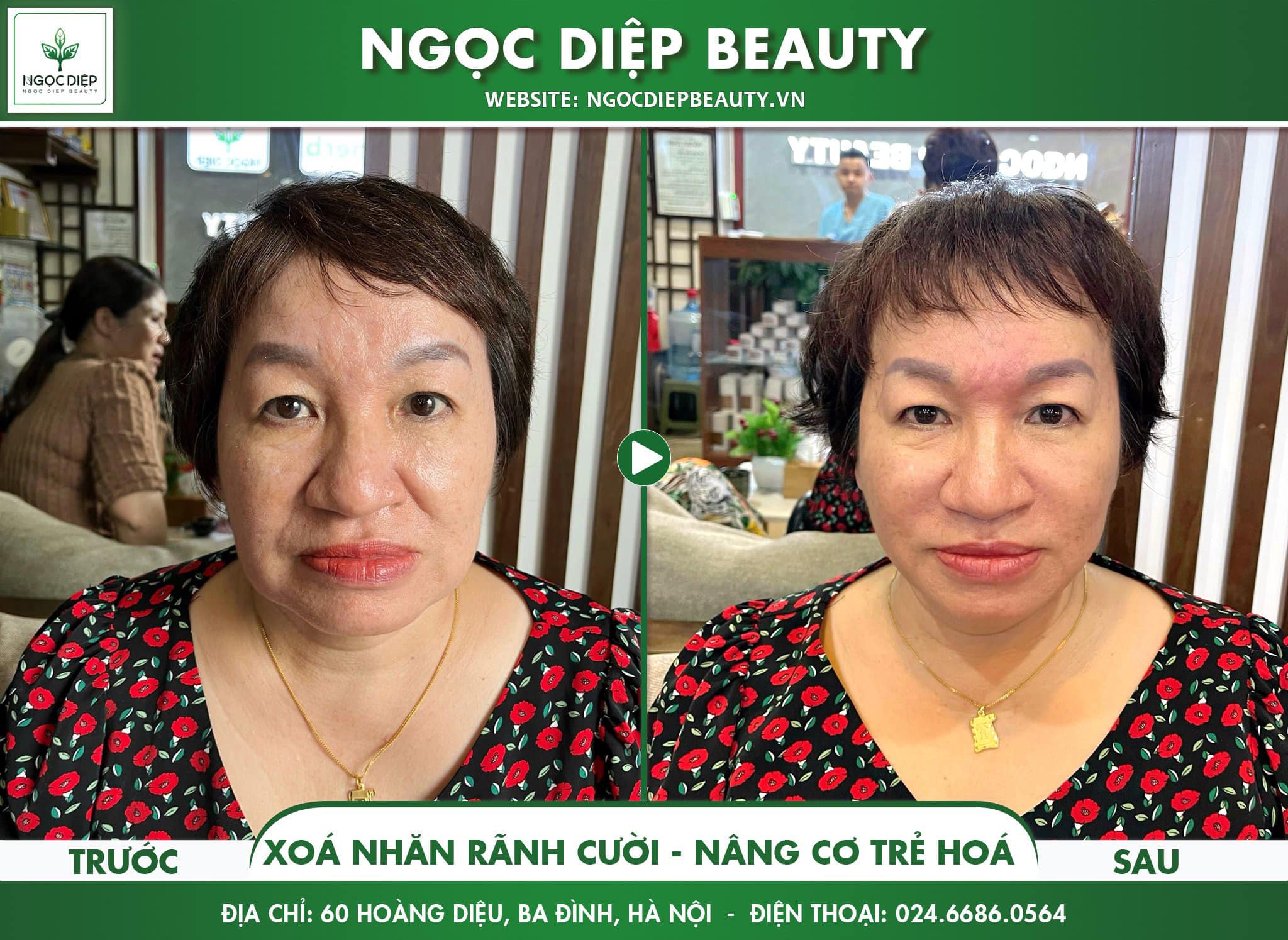 Ngọc Diệp Beauty ảnh 1