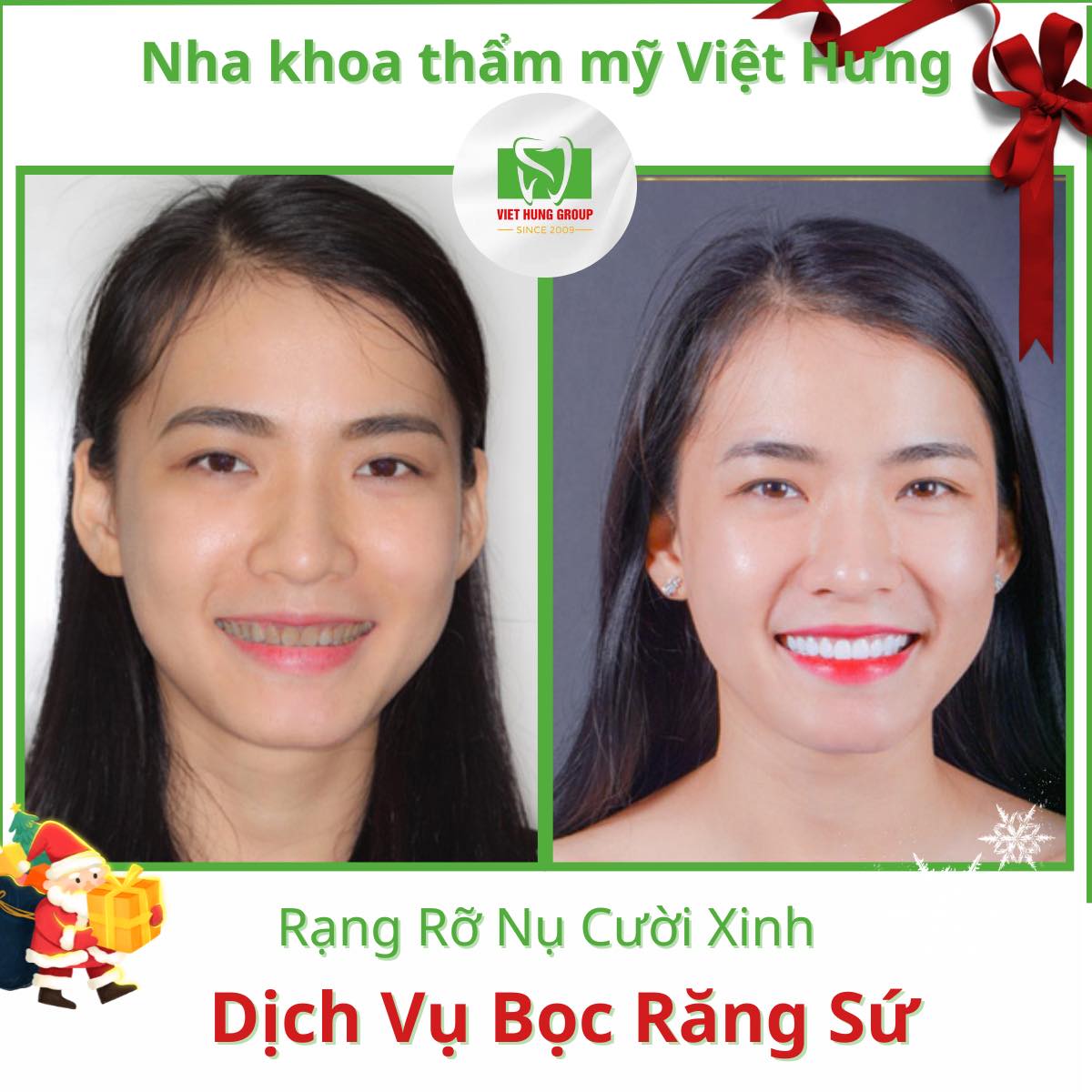 Nha Khoa Thẩm Mỹ Việt Hưng ảnh 1