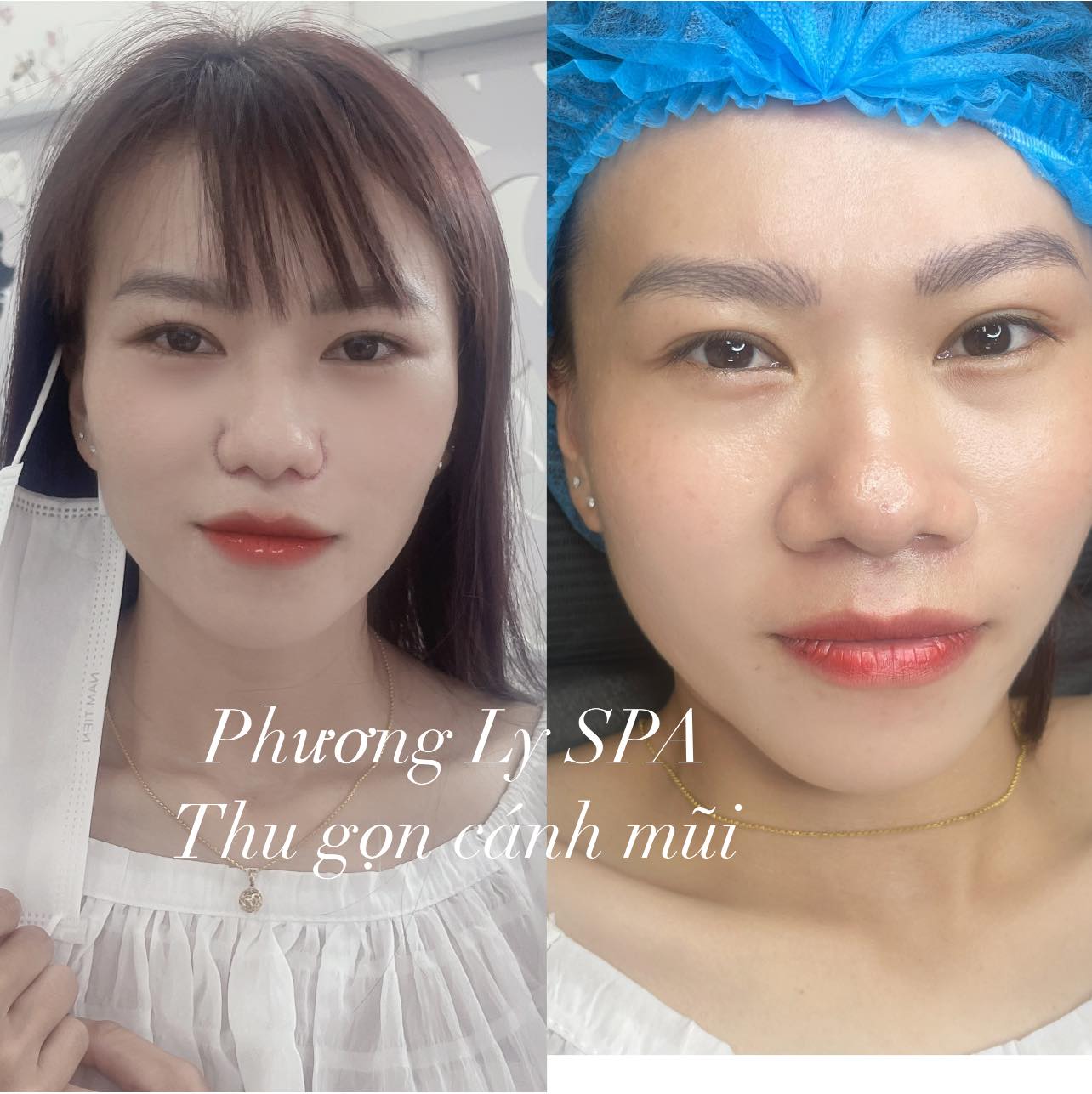 Phương Ly Beauty - Spa ảnh 3