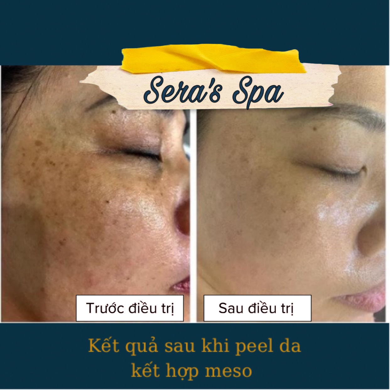 Sera’s Spa & Clinic ảnh 1