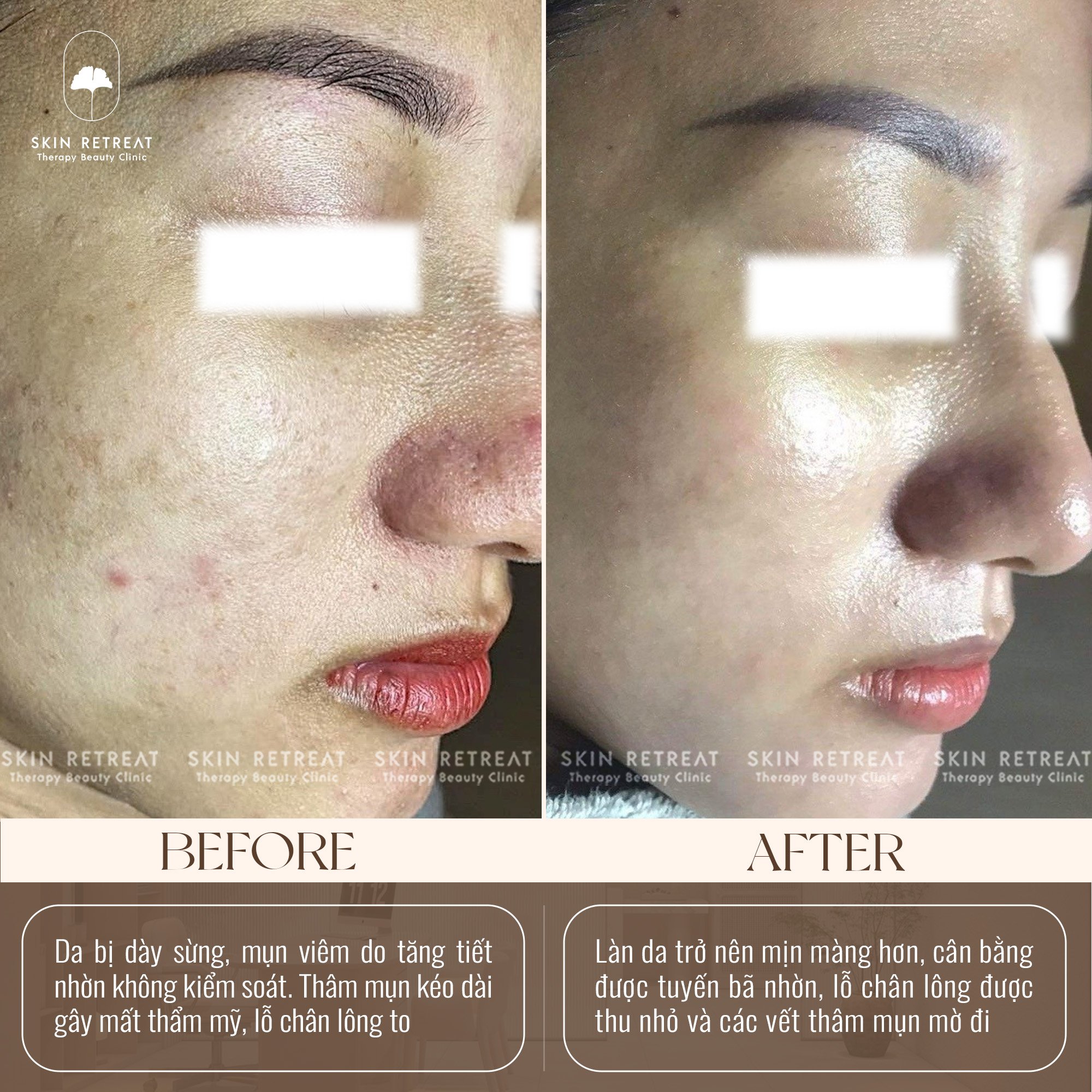 Skin Retreat ảnh 1