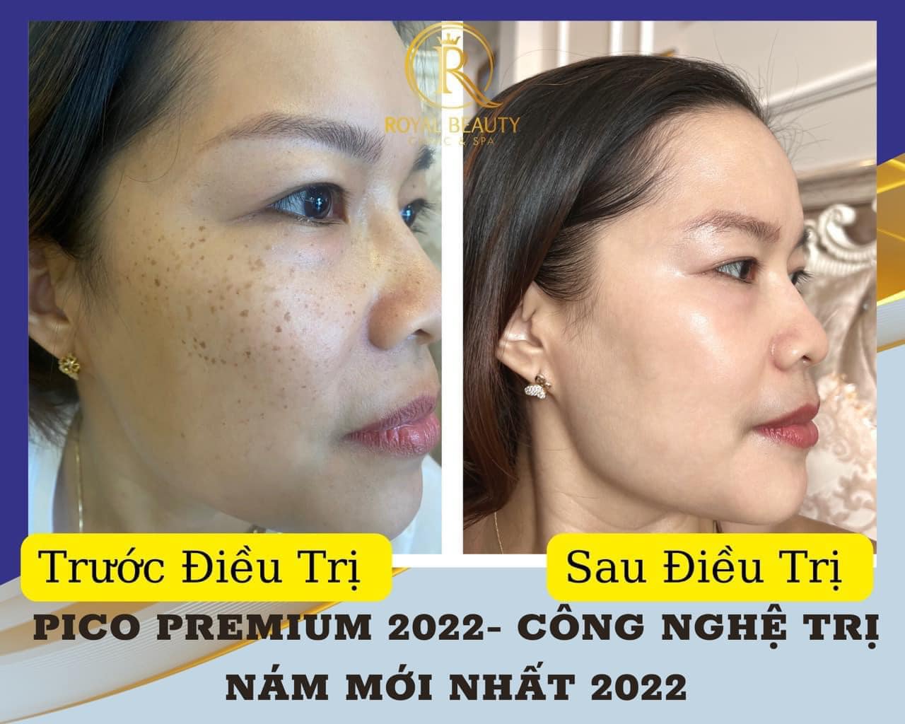 Spa làm đẹp uy tín và chất lượng nhất Tp. Quy Nhơn, Bình Định