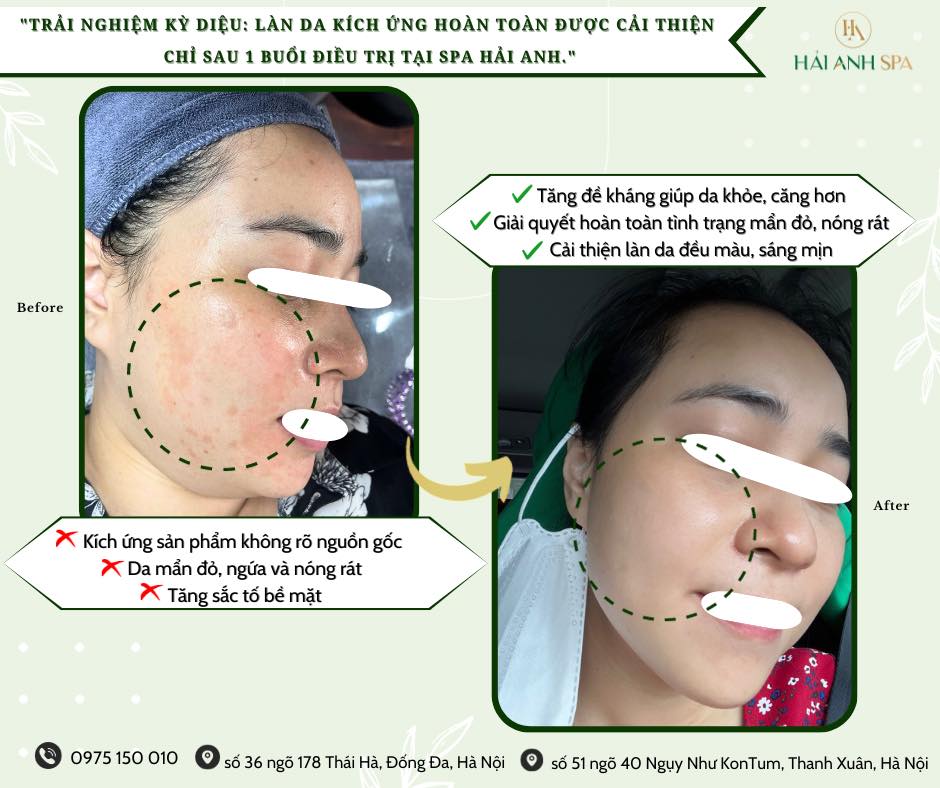 Spa Hải Anh ảnh 2