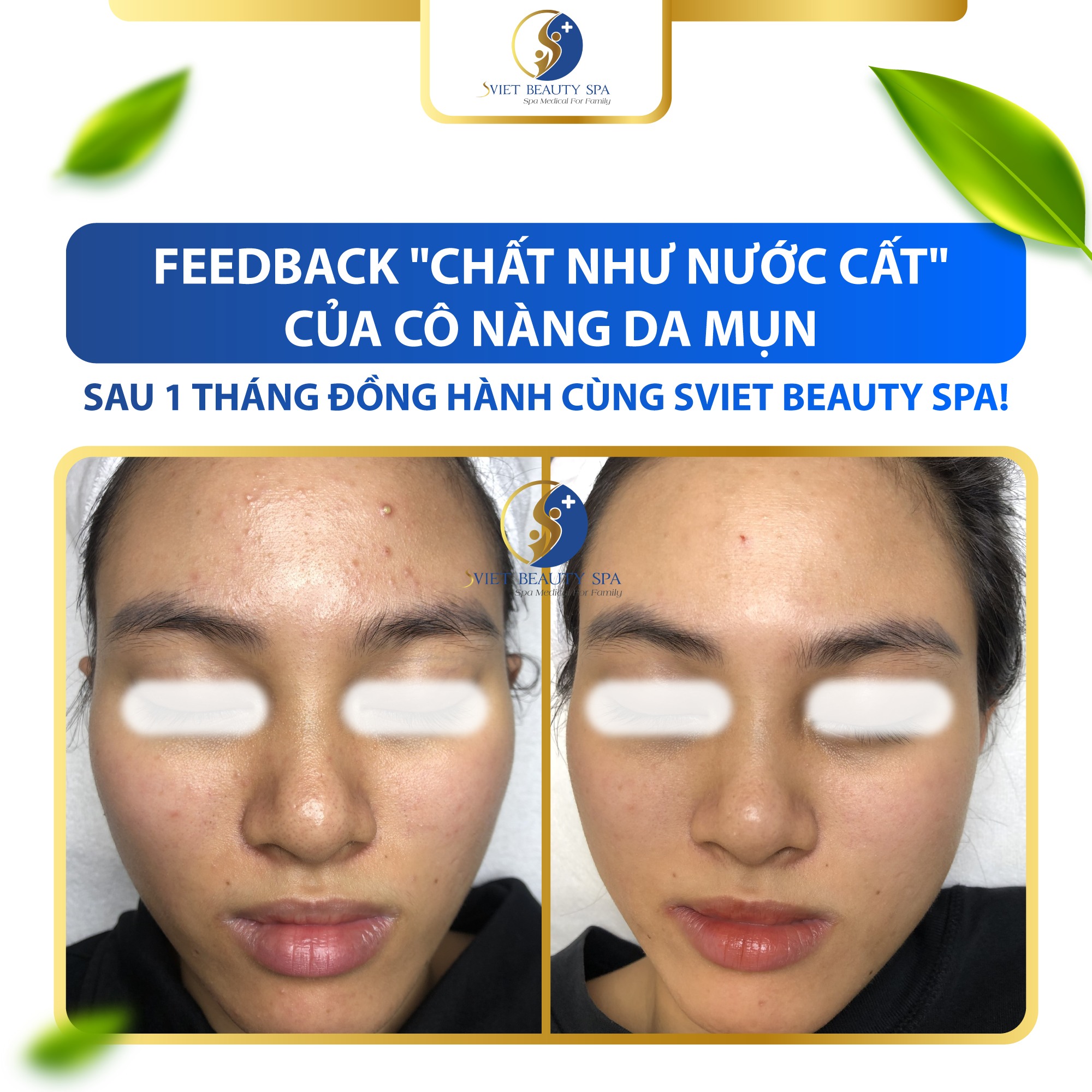 Sviet Beauty Spa ảnh 2