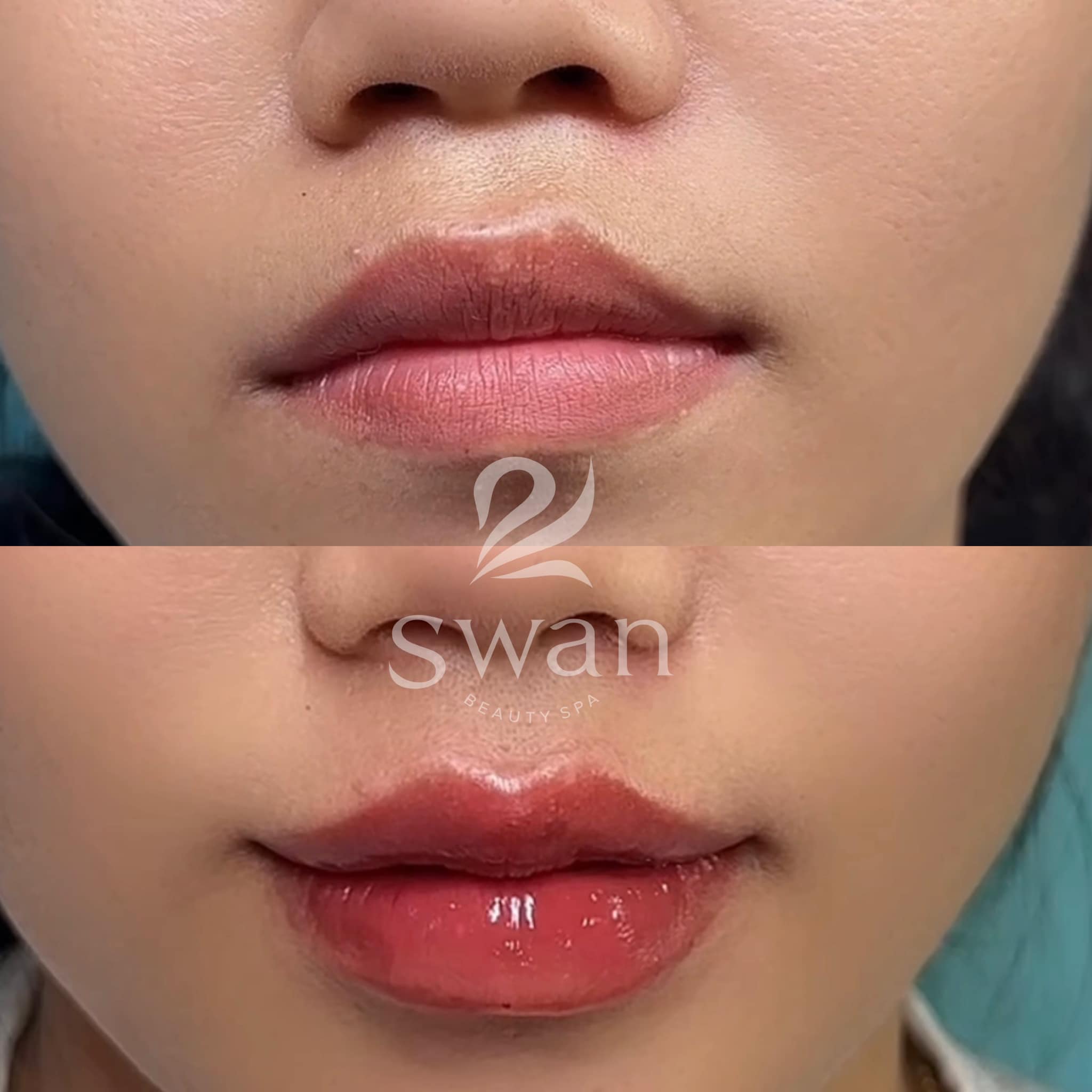 Swan Beauty Spa ảnh 1