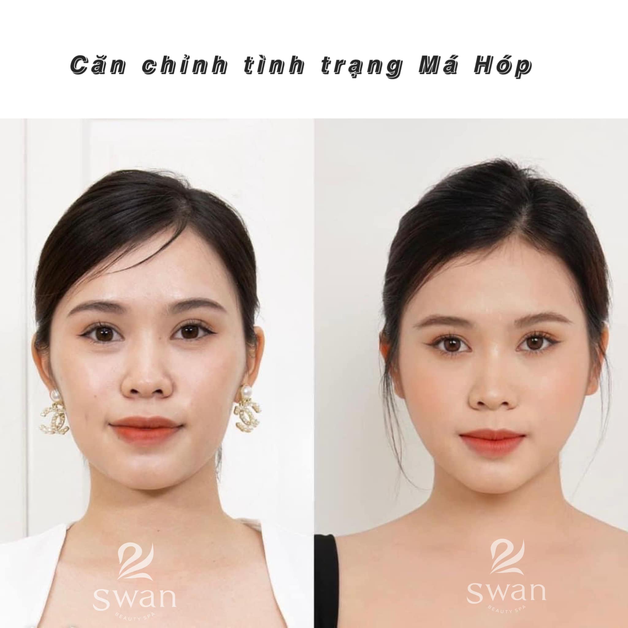 Swan Beauty Spa ảnh 2