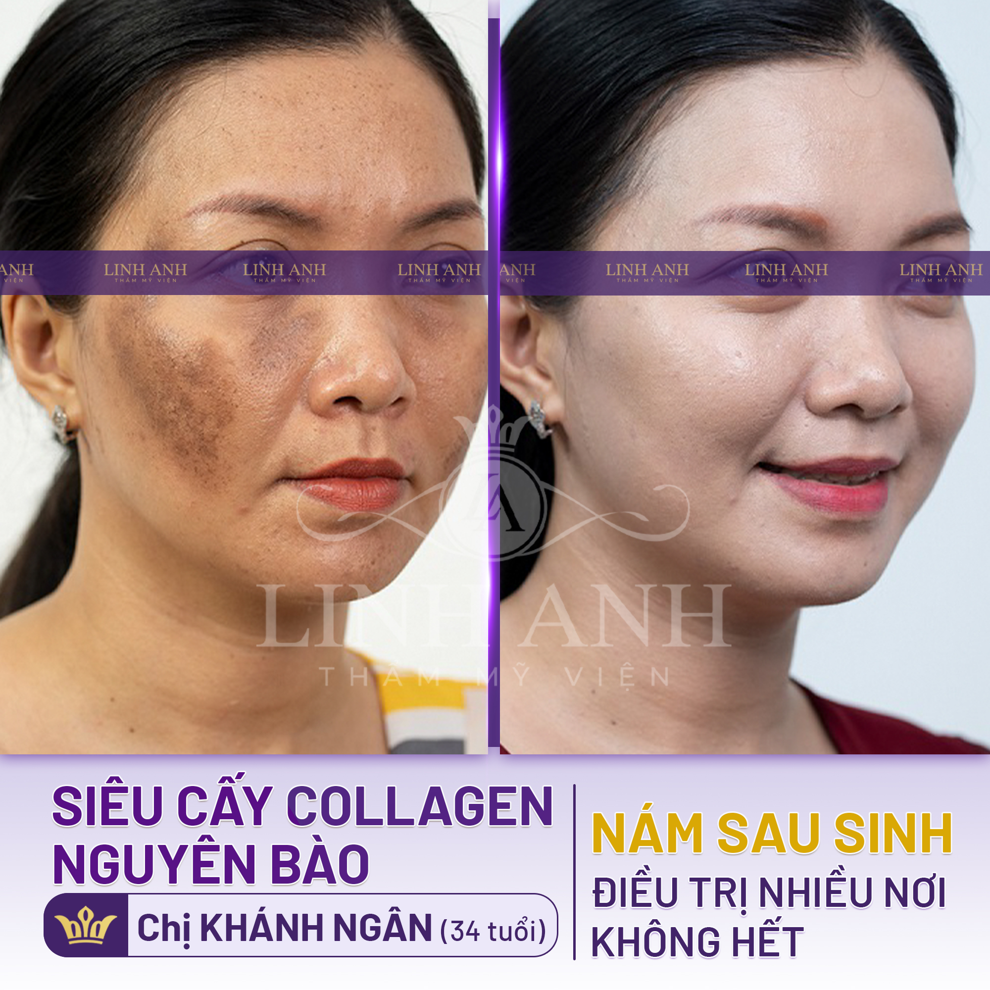 Viện Thẩm Mỹ Quốc Tế Linh Anh ảnh 2