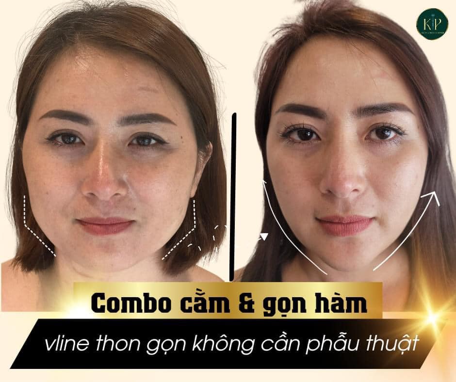 Thẩm mỹ viện Kiều Phương ảnh 2