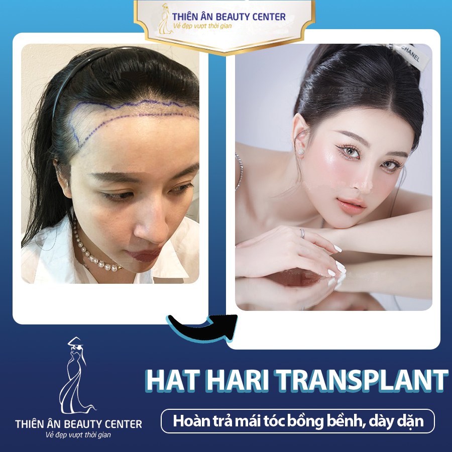 Thiên Ân Beauty Center ảnh 1