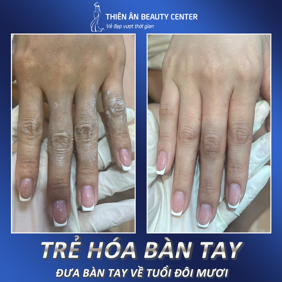 Thiên Ân Beauty Center ảnh 2