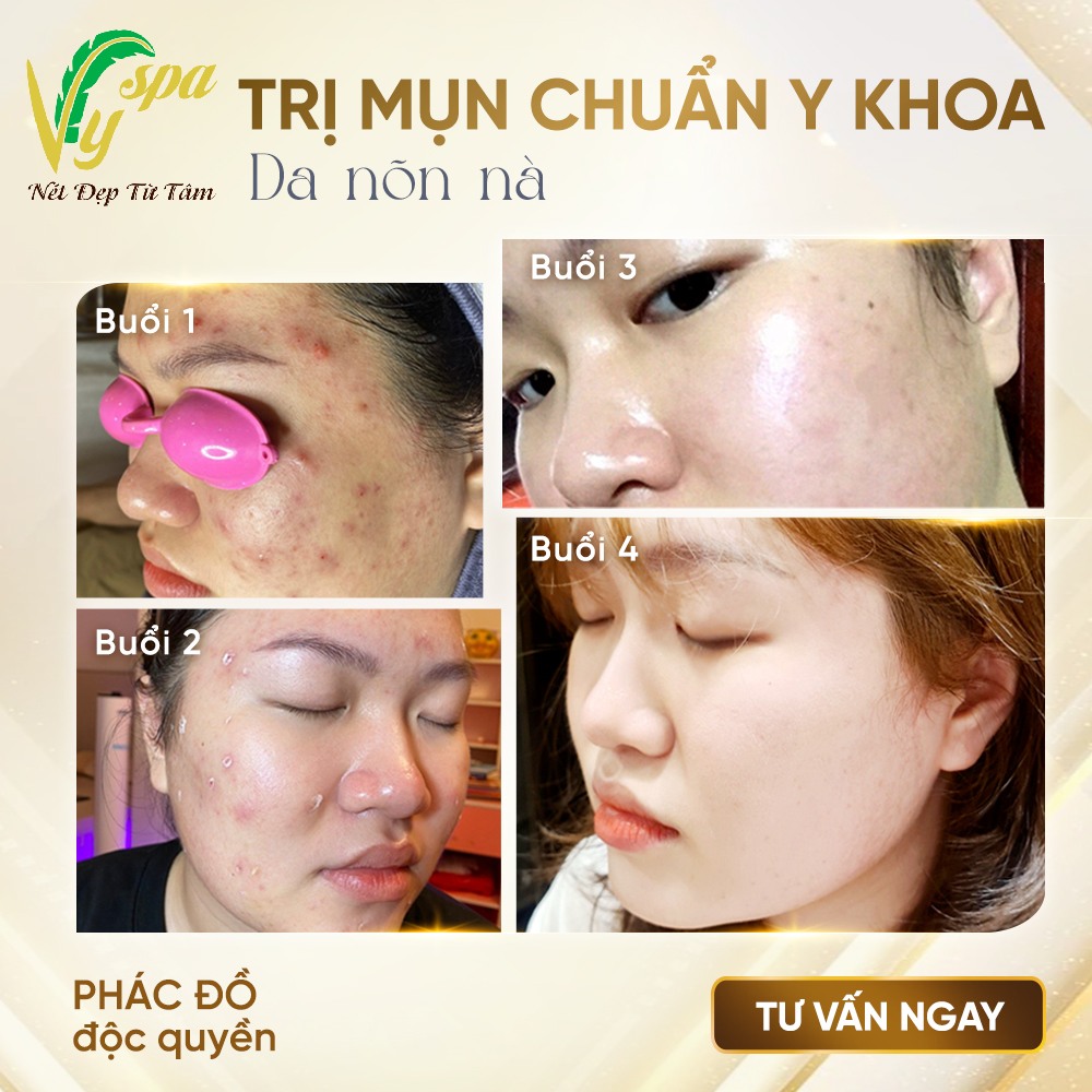 Vy Spa & Skin Care Center ảnh 1