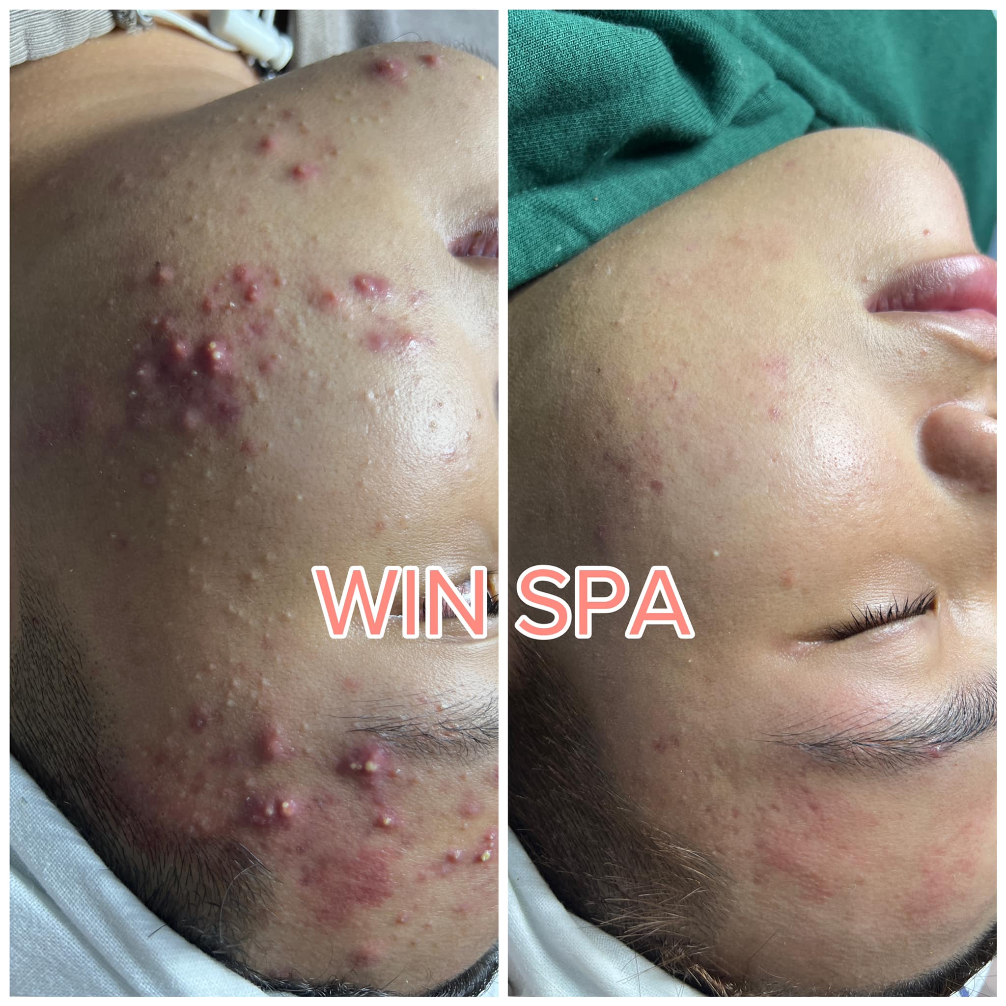 WIN Spa ảnh 1