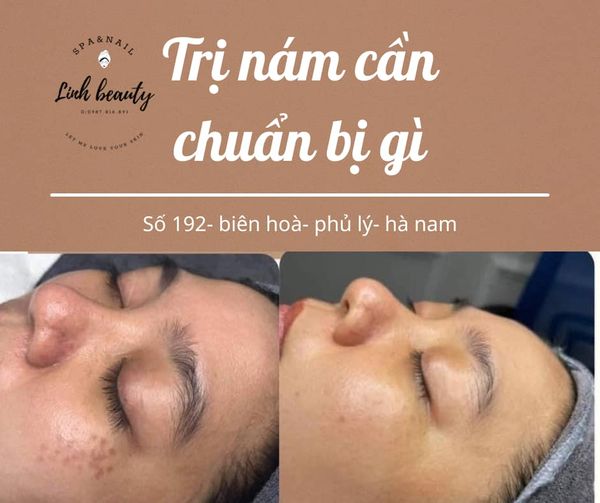 Linh Beauty Spa ảnh 2