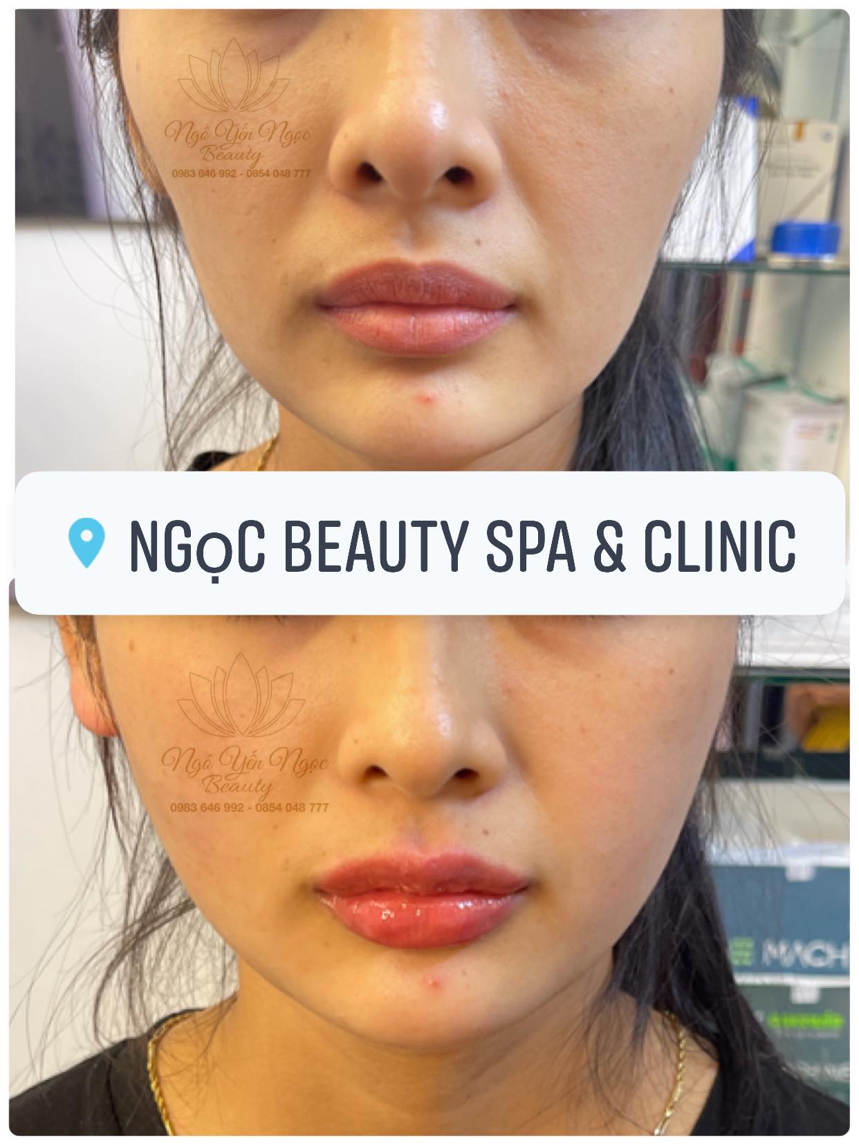 Ngọc Beauty Spa & Clinic ảnh 2