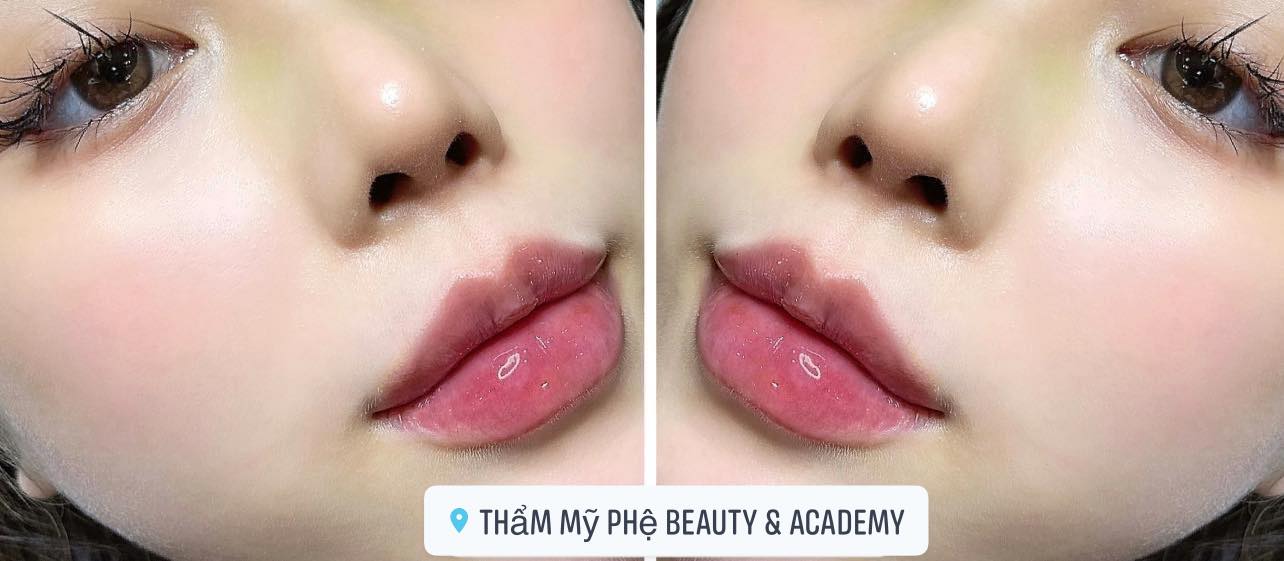 Phệ Beauty & Academy ảnh 1