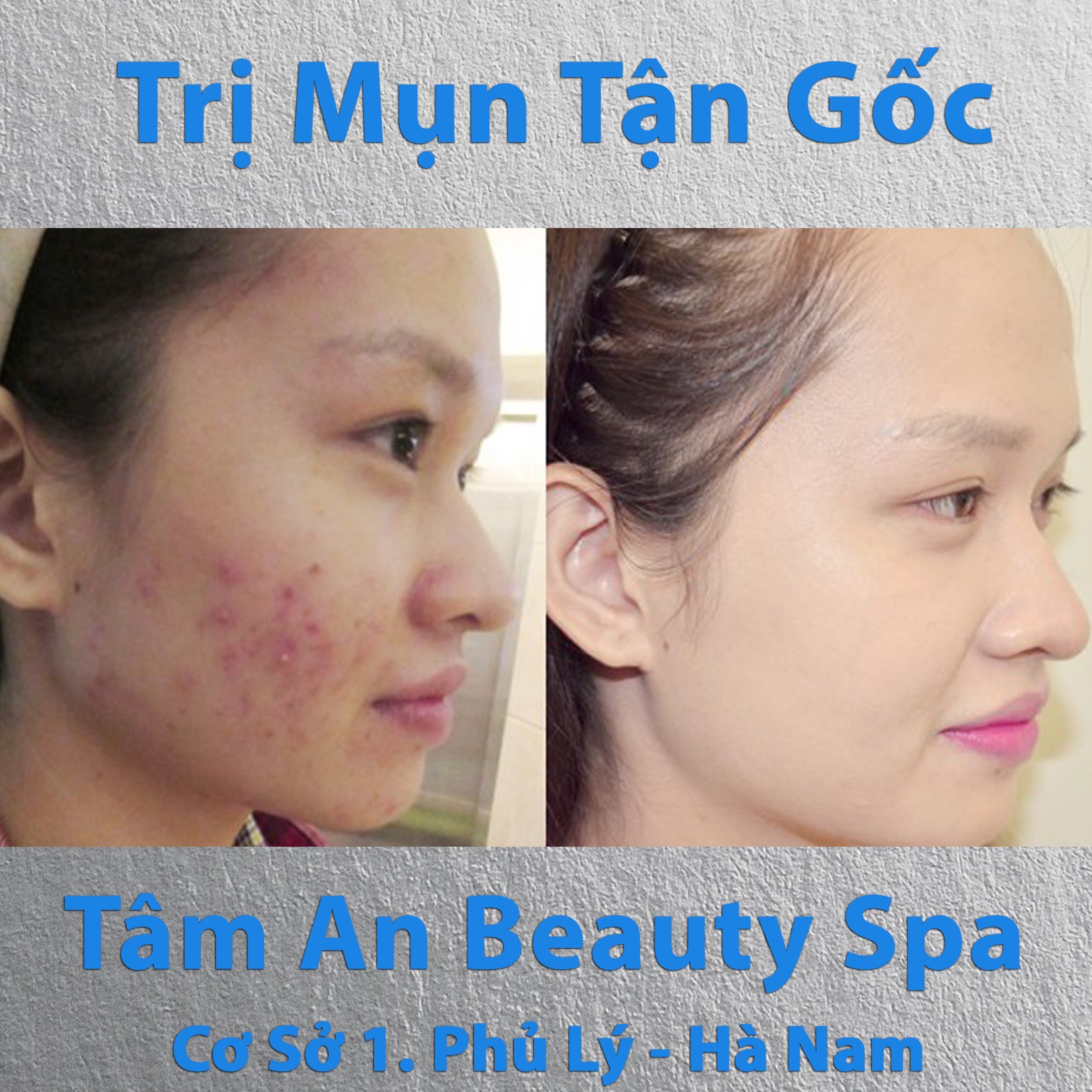 Tâm An Beauty Spa Phủ Lý Hà Nam ảnh 2