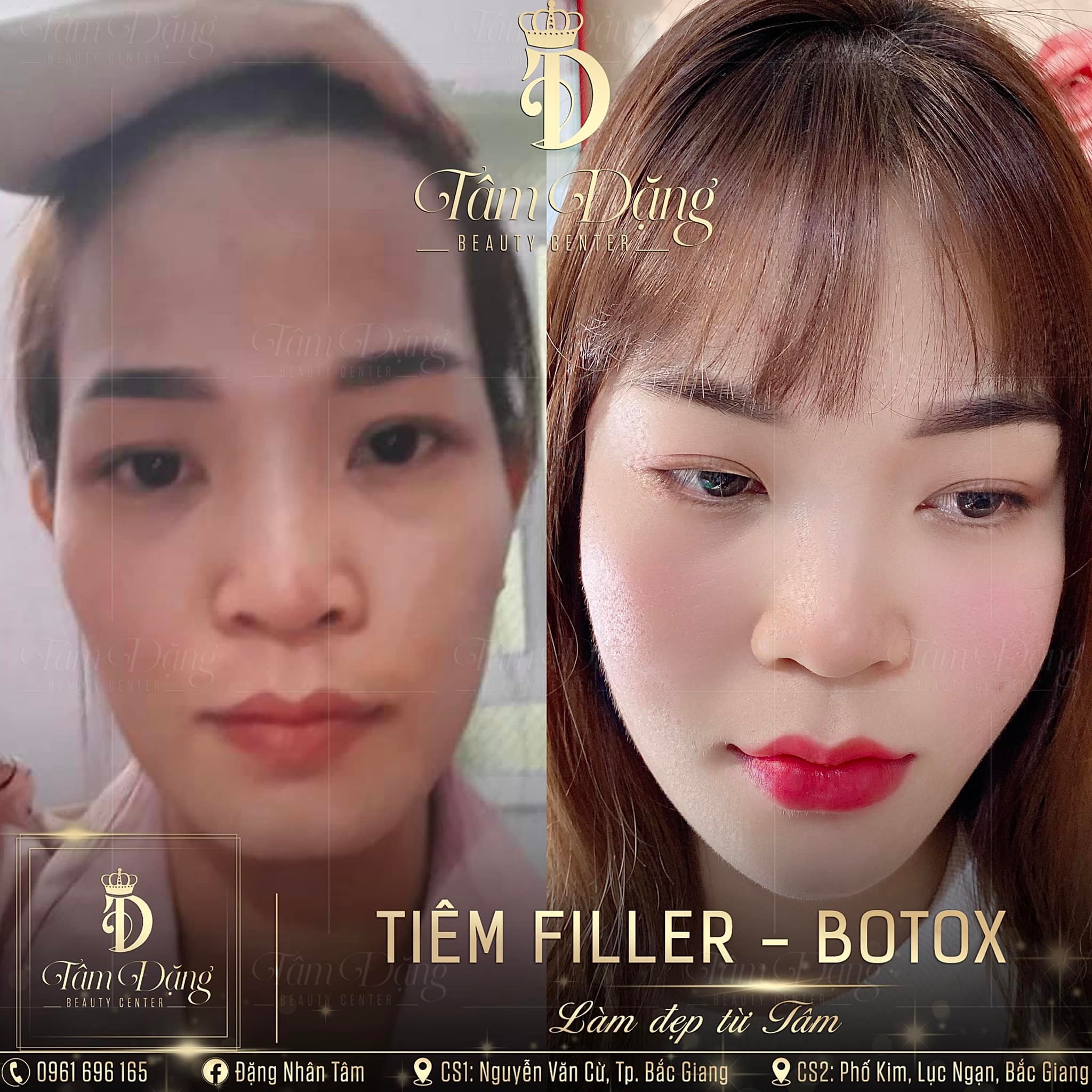 Tâm Beauty Center ảnh 2