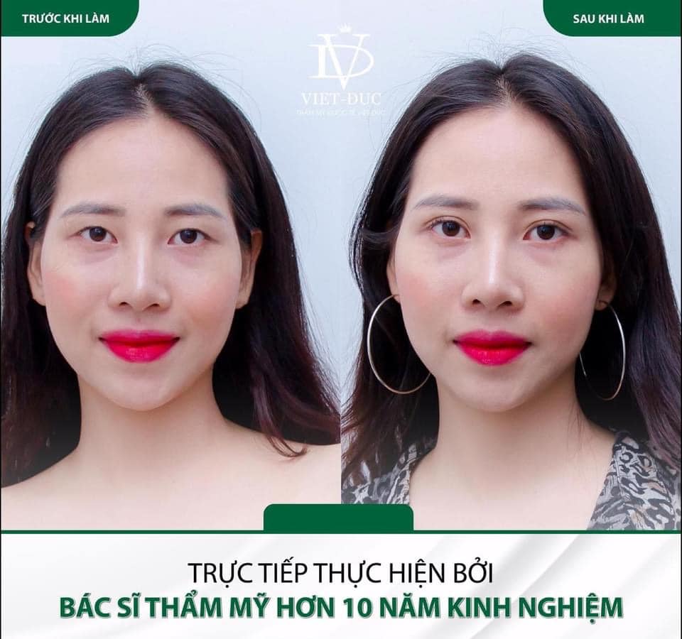 Thẩm Mỹ Quốc Tế Việt Đức ảnh 2