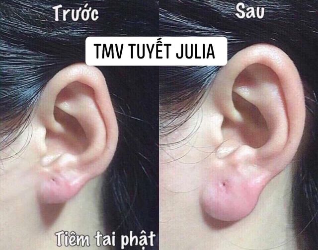 Thẩm mỹ viện Tuyết Julia ảnh 1