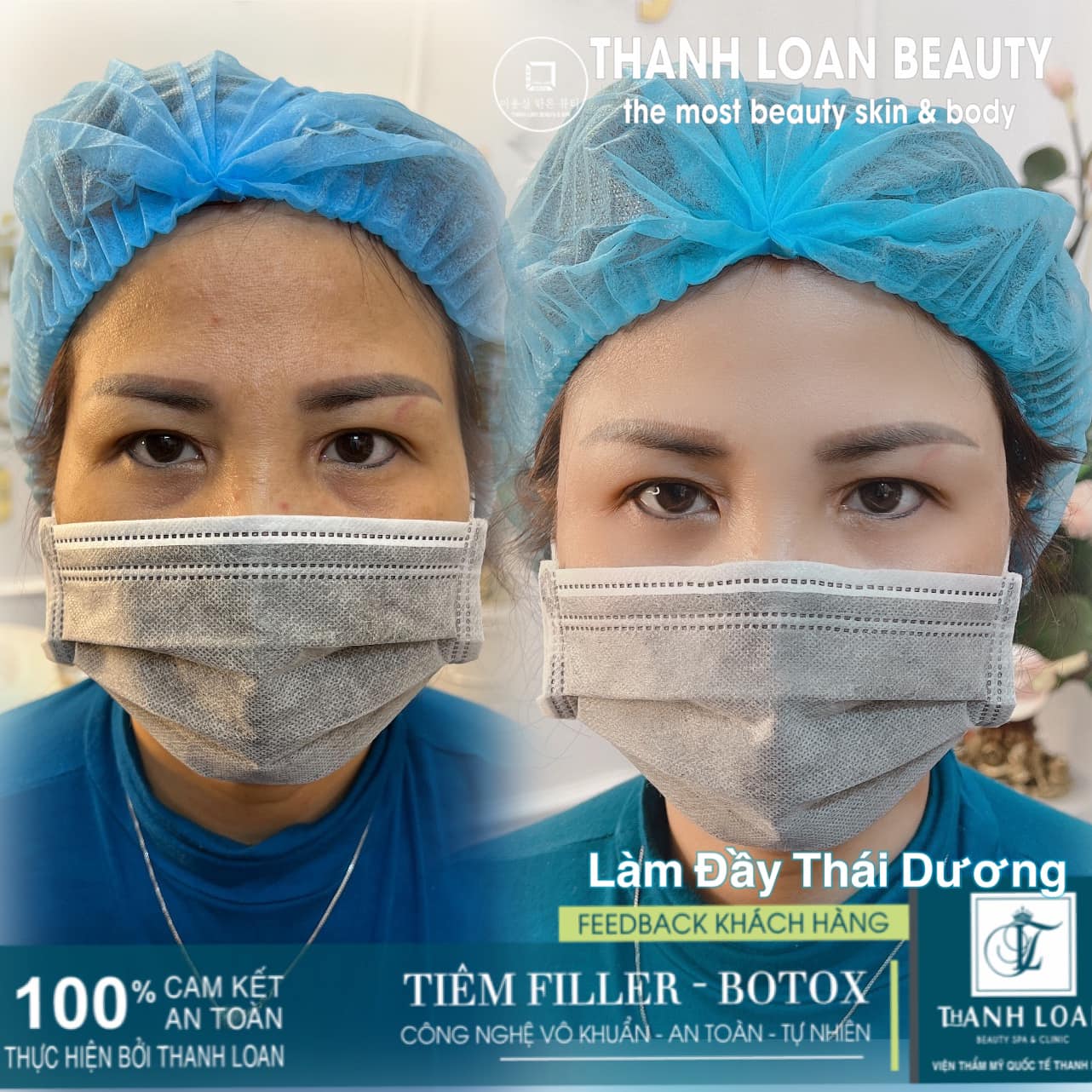 Thanh Loan Beauty & Spa ảnh 1