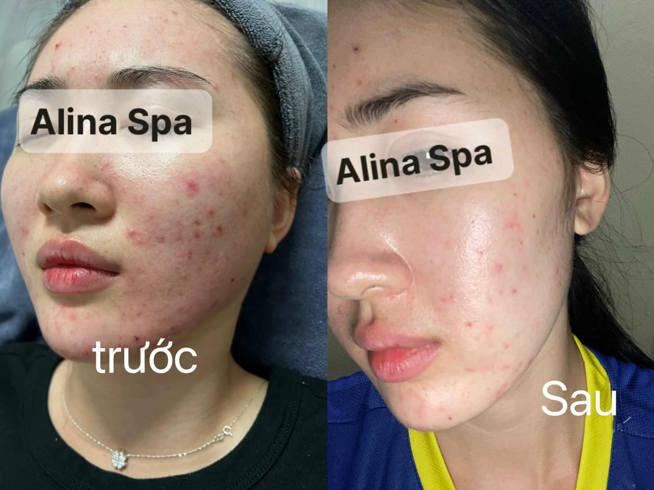 ALina Spa ảnh 1