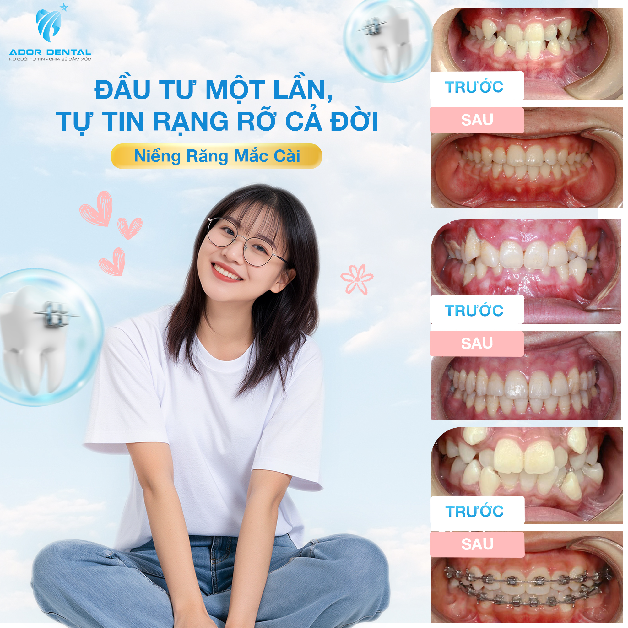 Ador Dental - Nha Khoa Thẩm Mỹ Quốc Tế ảnh 2
