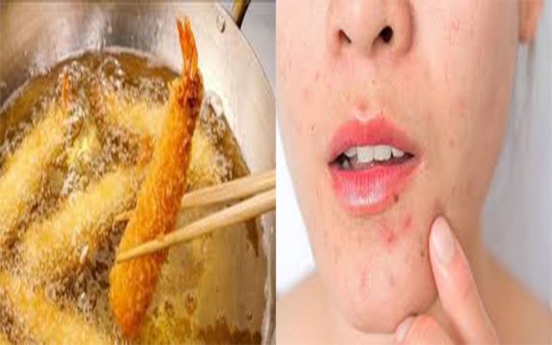 Ăn ít đồ ngọt, đồ nhiều dầu mỡ ảnh 2