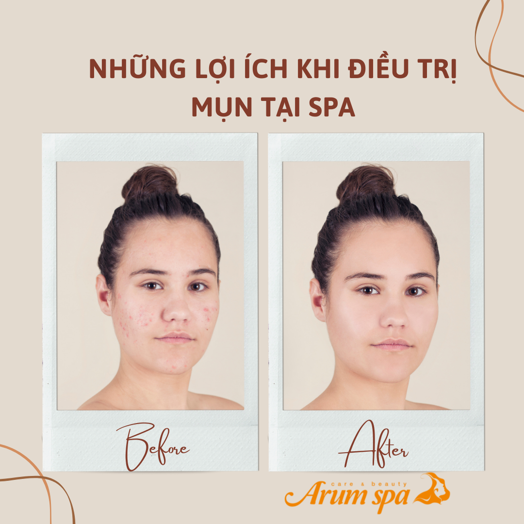 Arum Spa - Care & Beauty ảnh 2