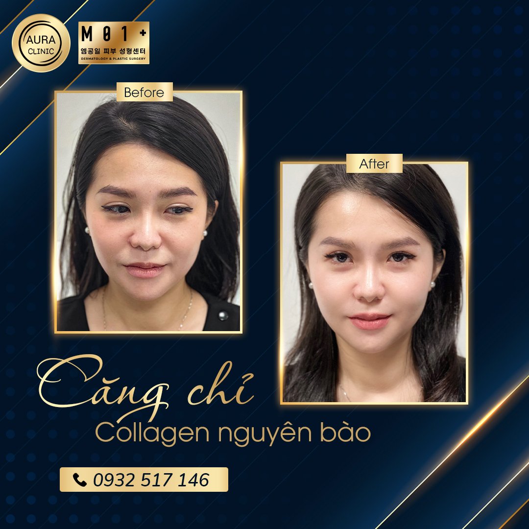 Aura Beauty Clinic - ABC ảnh 1