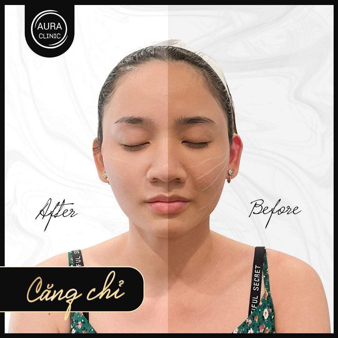 Aura Beauty Clinic - ABC ảnh 2