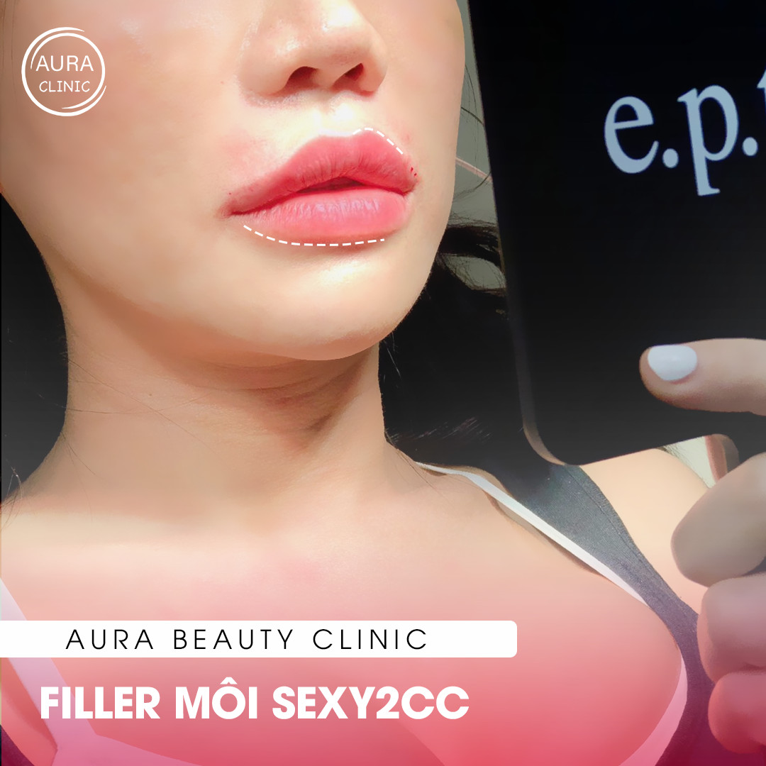 Aura Beauty Clinic - ABC ảnh 2