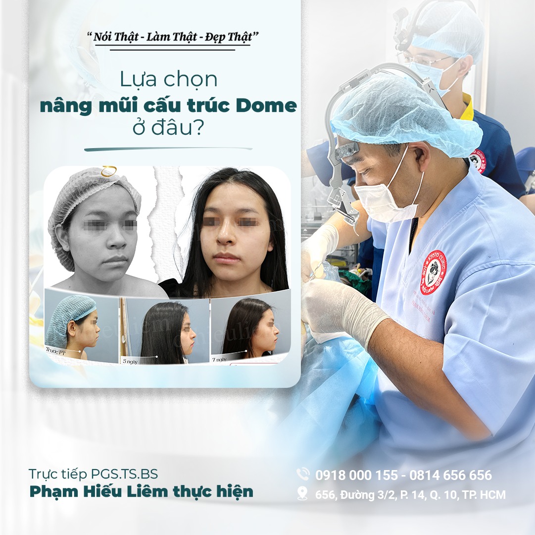 Phẫu thuật Nâng Mũi Cấu Trúc Dome của Bác sĩ Phạm Hiếu Liêm ảnh 1