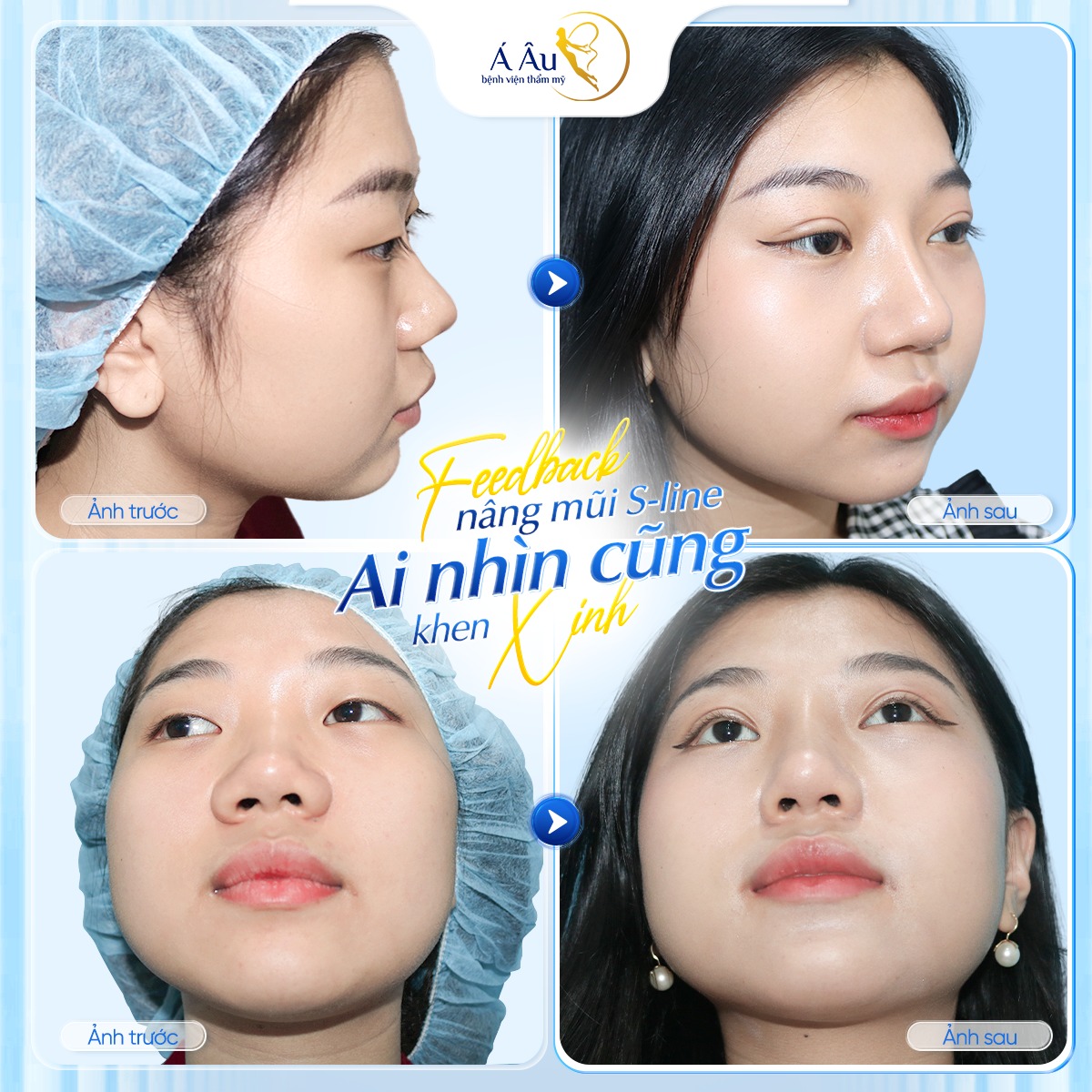 Bệnh Viện Thẩm Mỹ Á Âu ảnh 1