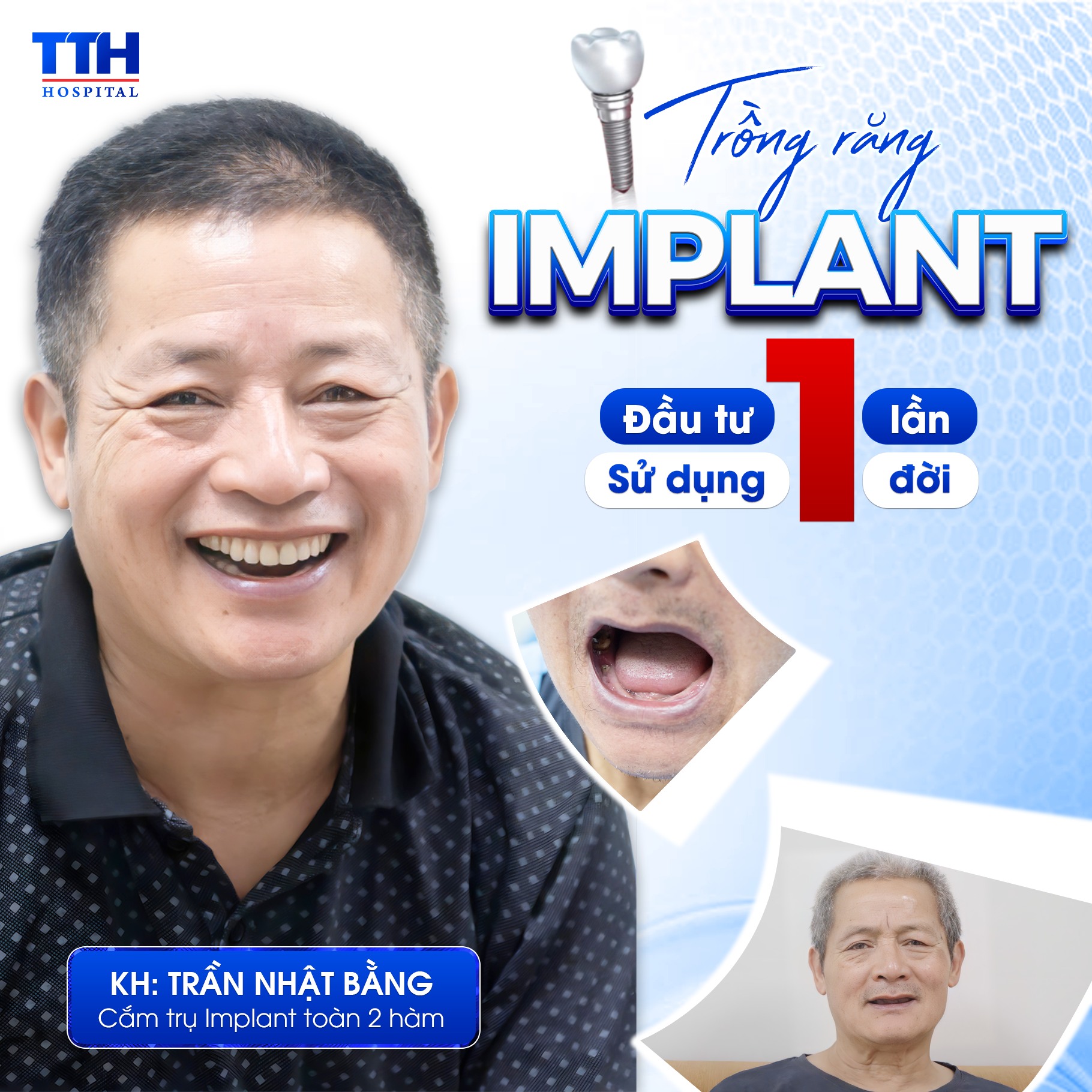 Bệnh viện Thái Thượng Hoàng ảnh 2