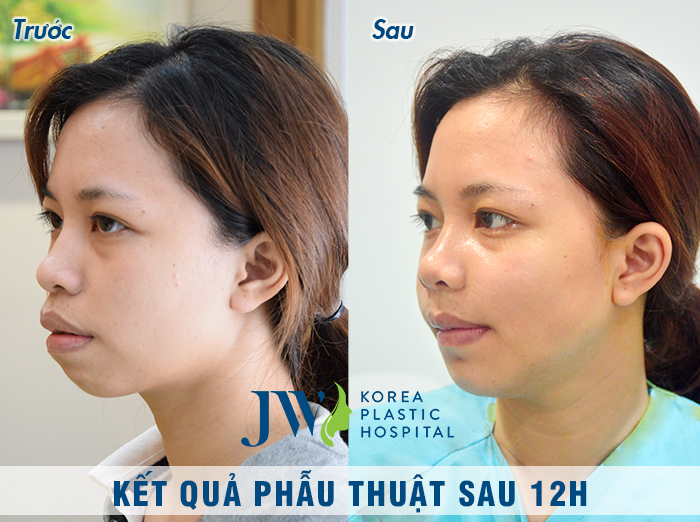 Bệnh viện Thẩm mỹ JW Hàn Quốc ảnh 2