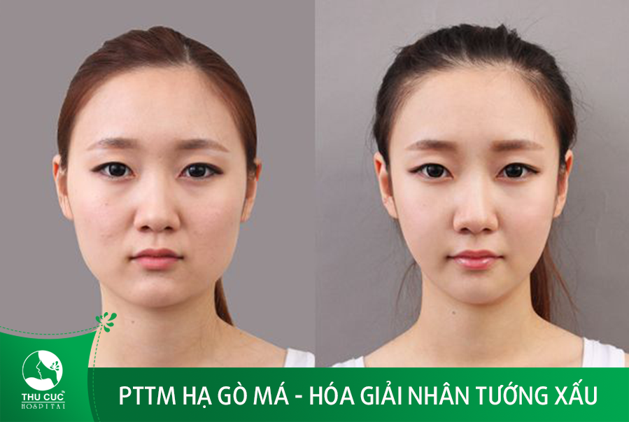 Bệnh Viện Thẩm Mỹ Thu Cúc ảnh 1