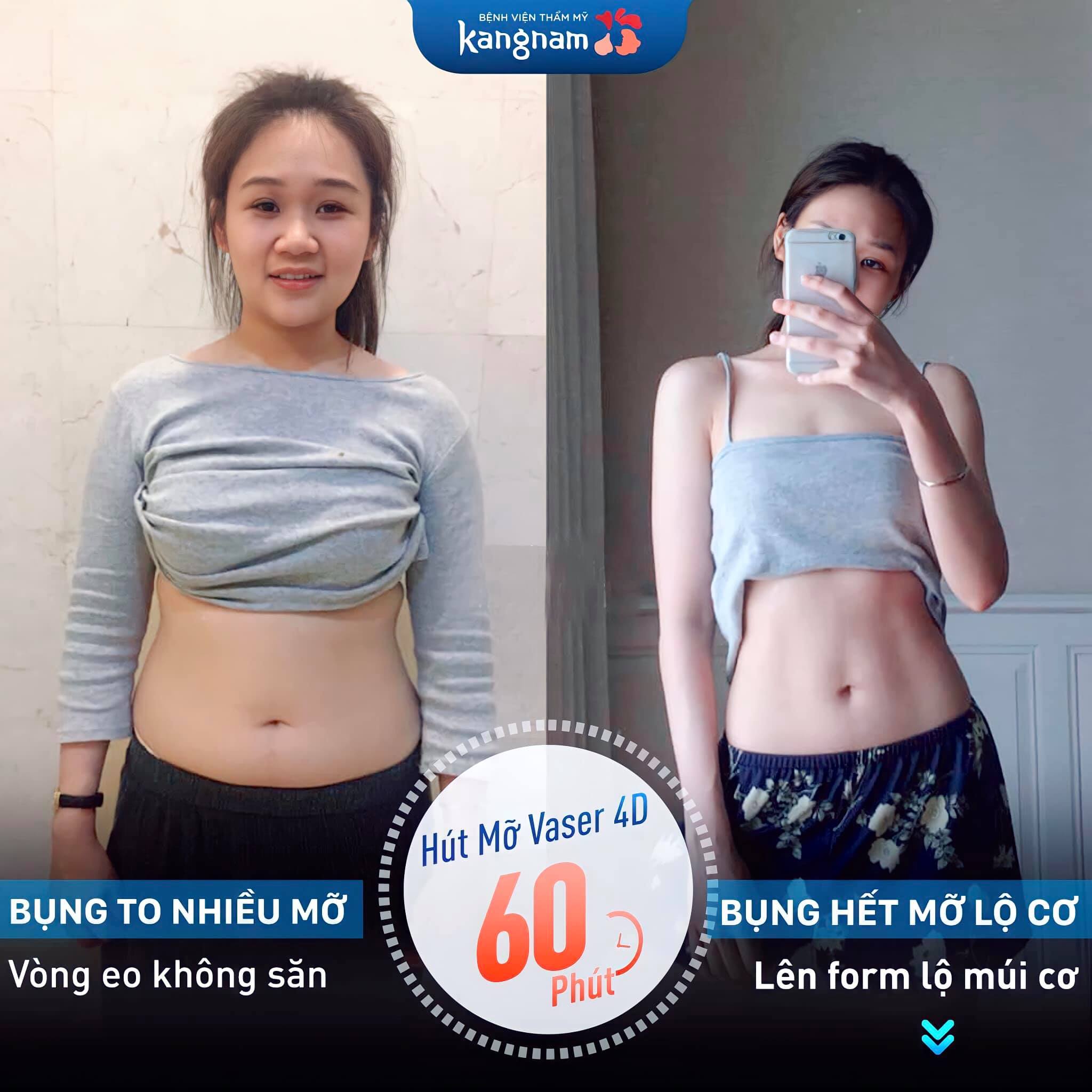 Bệnh viện thẩm mỹ Kangnam ảnh 1