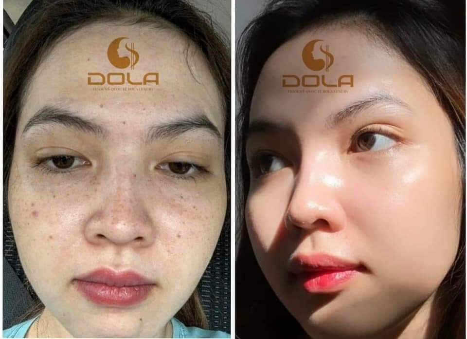 DOLA Xinh Spa ảnh 1