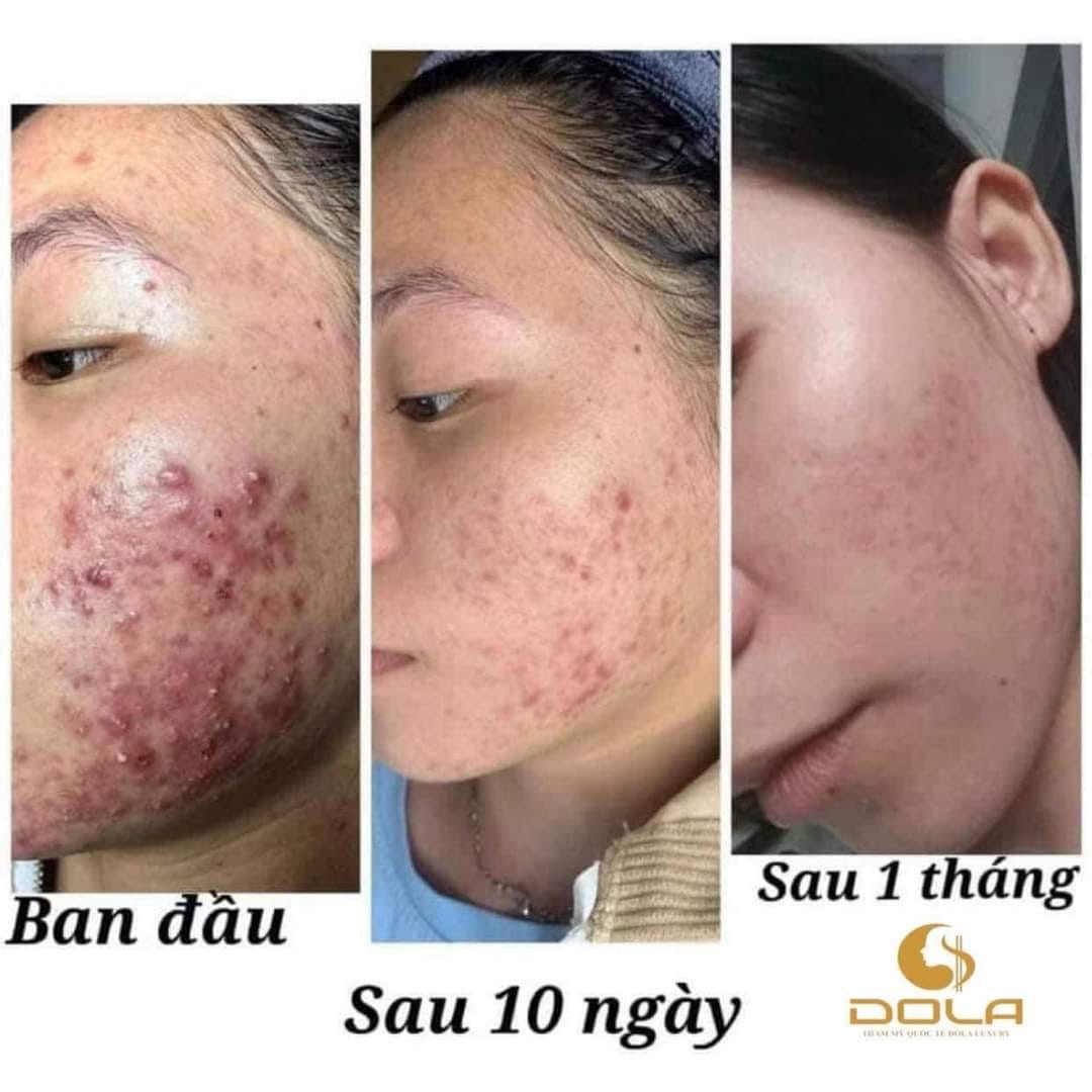 DOLA Xinh Spa ảnh 2