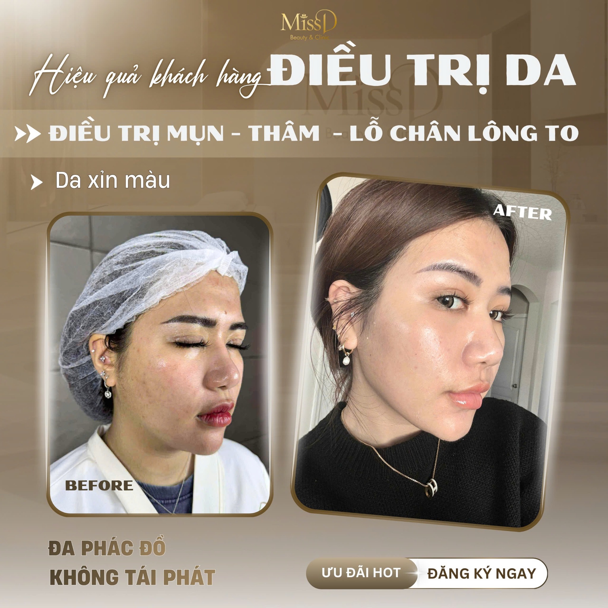 MissD Beauty & Clinic ảnh 1
