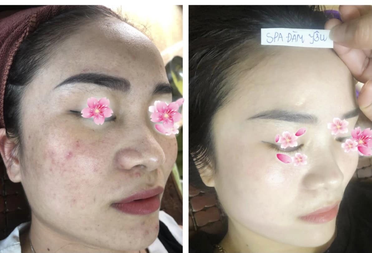 Đàm Yêu Spa ảnh 2