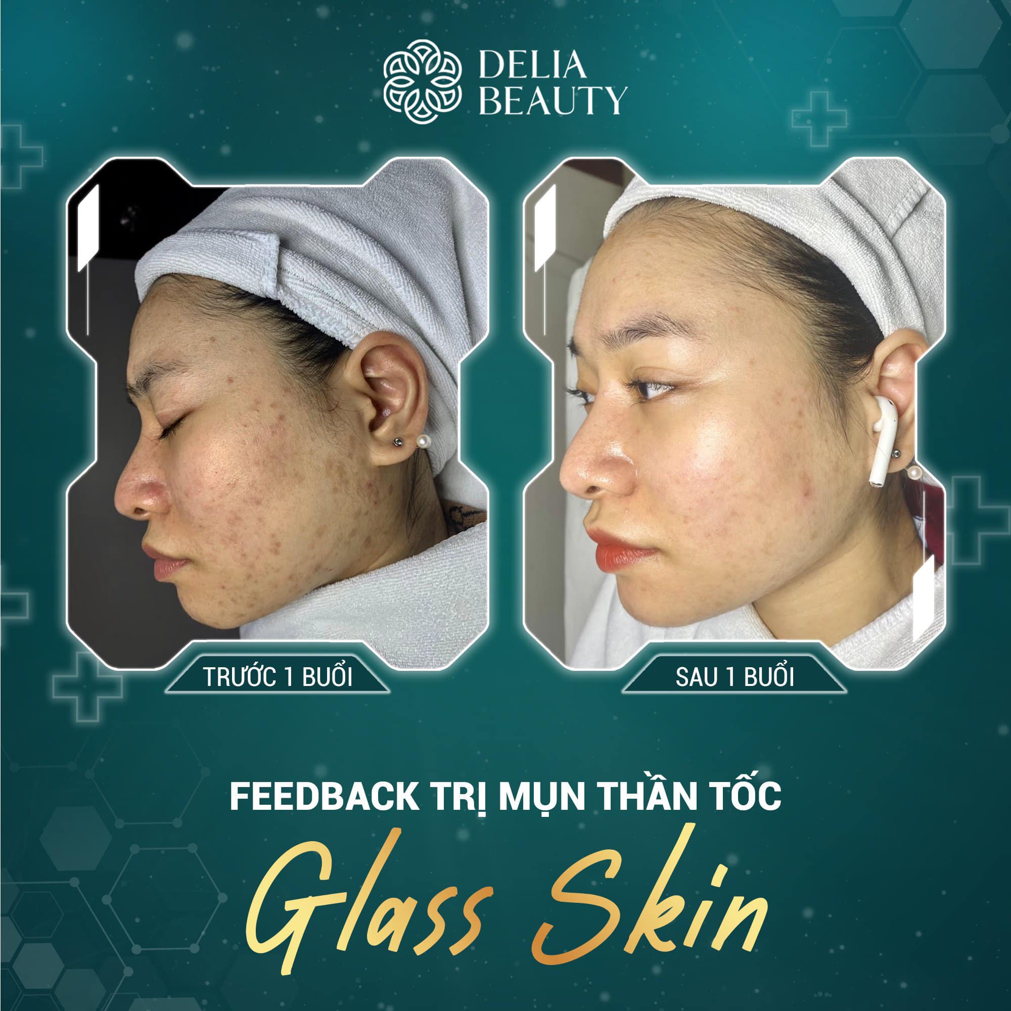 Delia Beauty ảnh 2