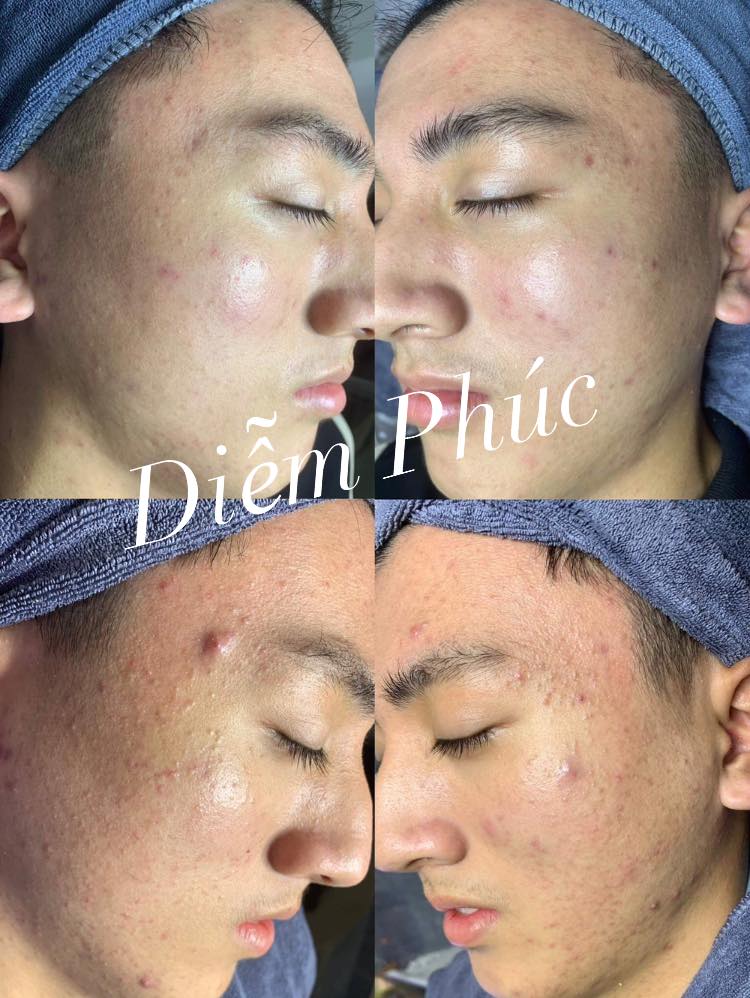 Diễm Phúc Beauty & Spa ảnh 2