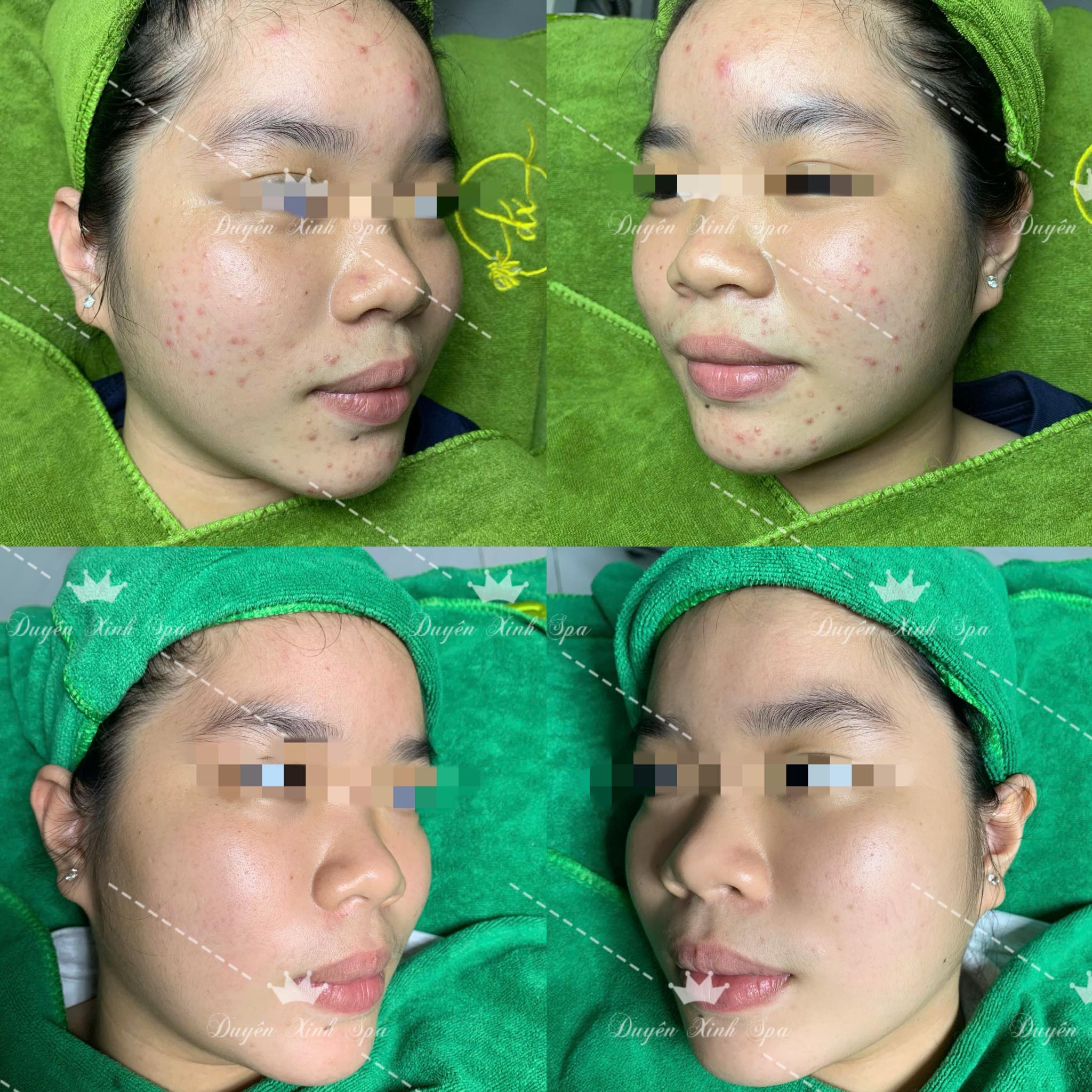 Duyên Xinh Spa ảnh 1