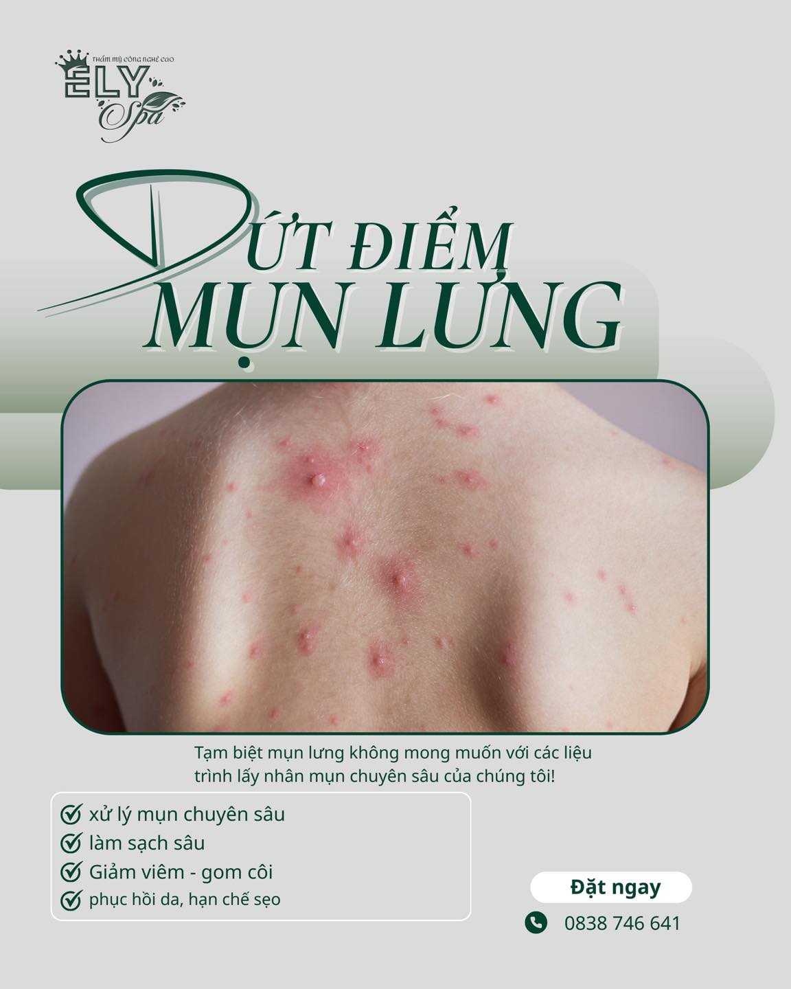 Êly Spa - Beauty Huế ảnh 2