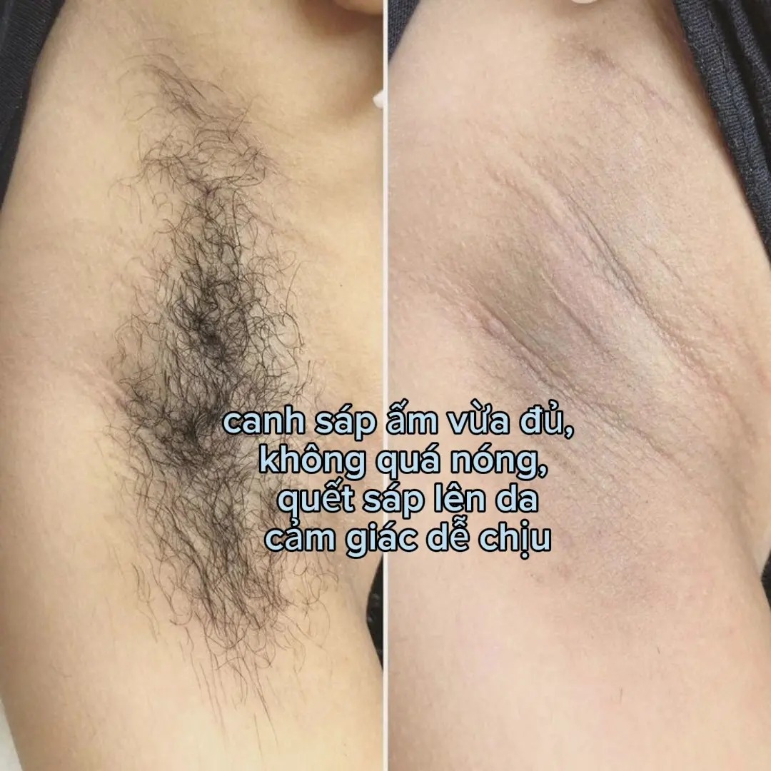 Gentle Waxing ảnh 1